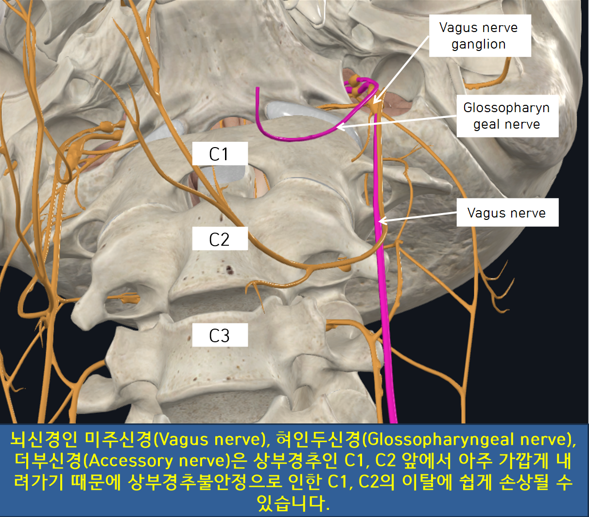 상부경추 부정렬과 이로 인한 증상 - 이수척한의원