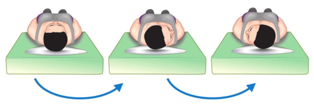 Supine roll test
