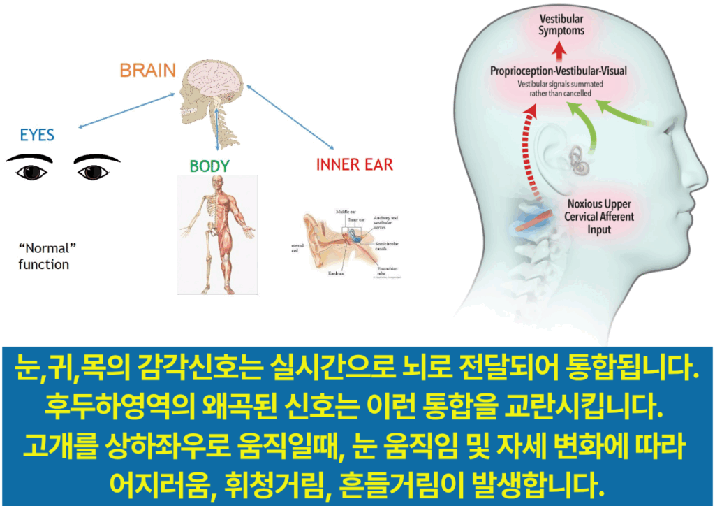 감각신호의 교란과 불일치는 어지럼증의 원인